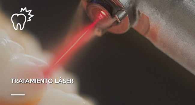 tratamiento-laser-odontologia-2022