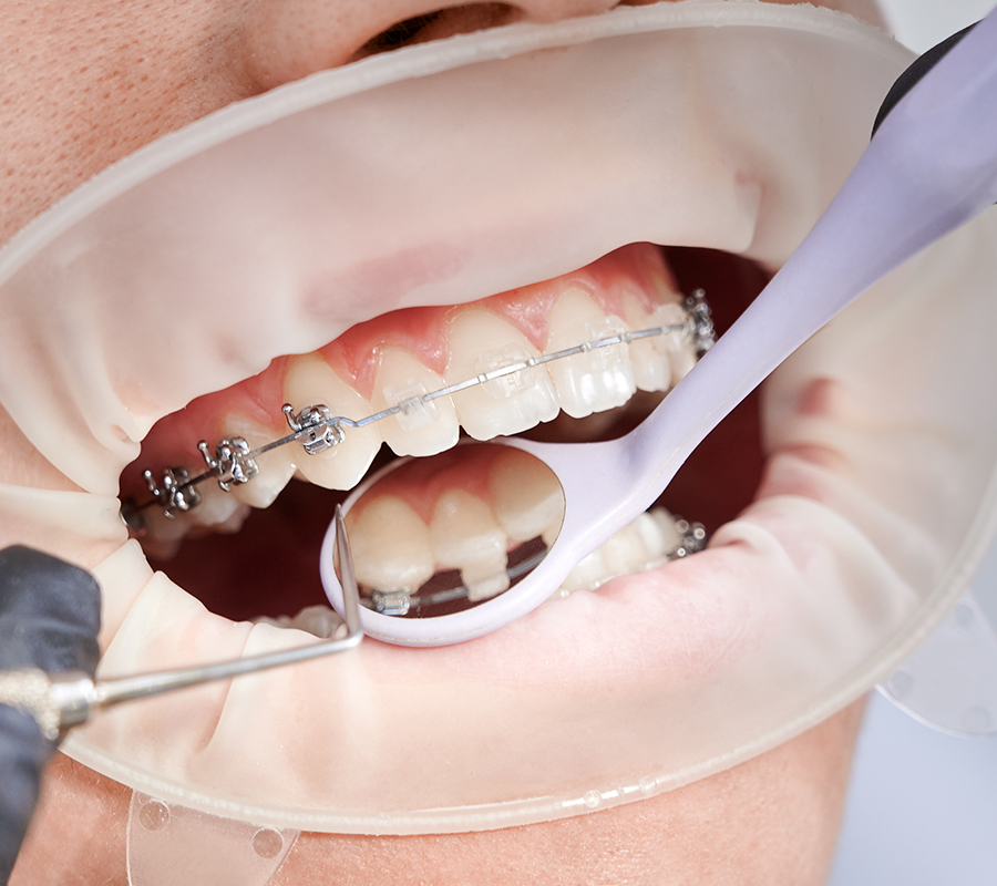 ortodoncia-clinica-dental-001